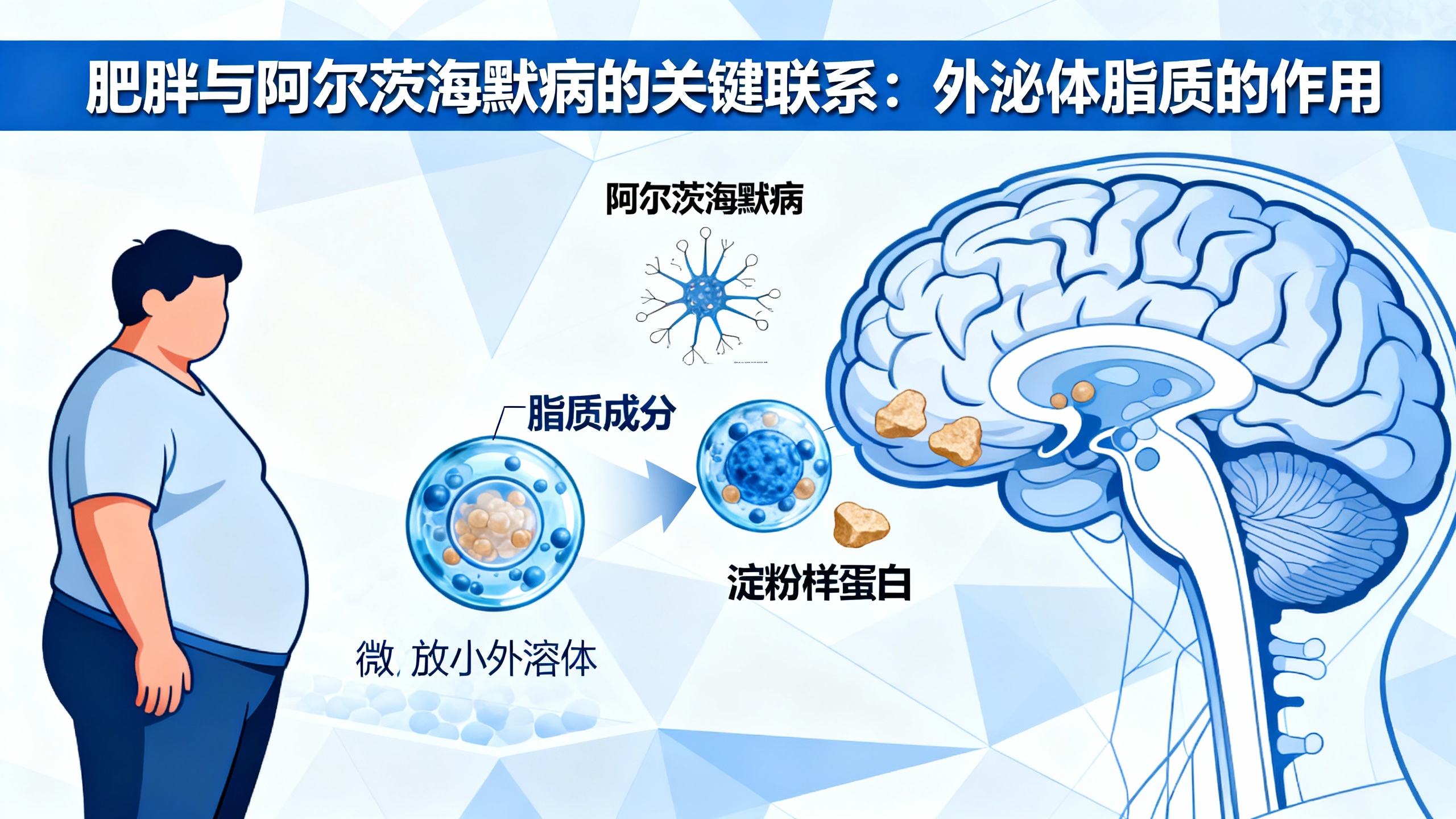 脂肪可能悄悄助长阿尔茨海默病,新研究发现