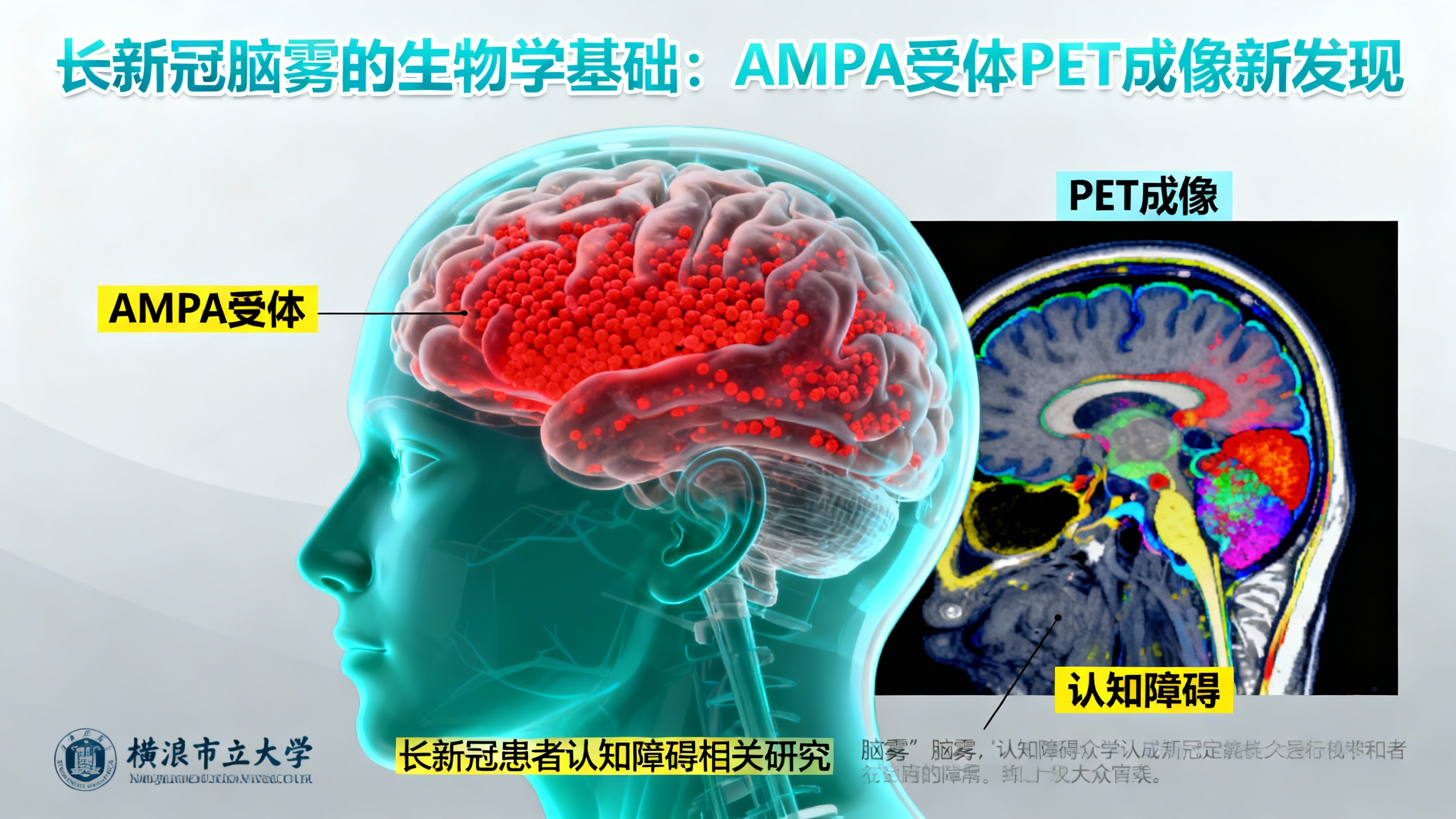 科学家终于揭开长期新冠“脑雾”之谜
