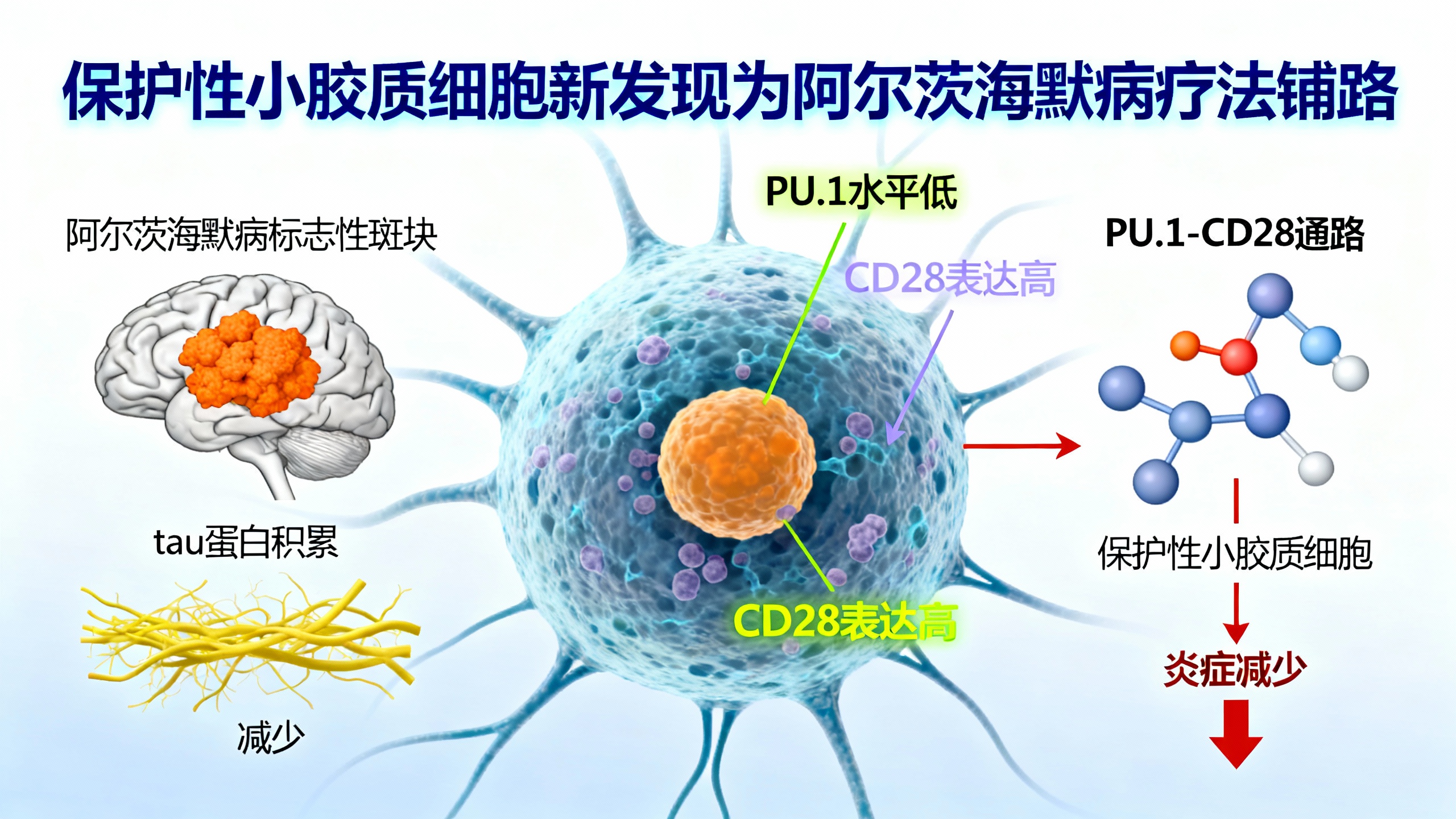 科学家发现可能阻止阿尔茨海默病的脑细胞