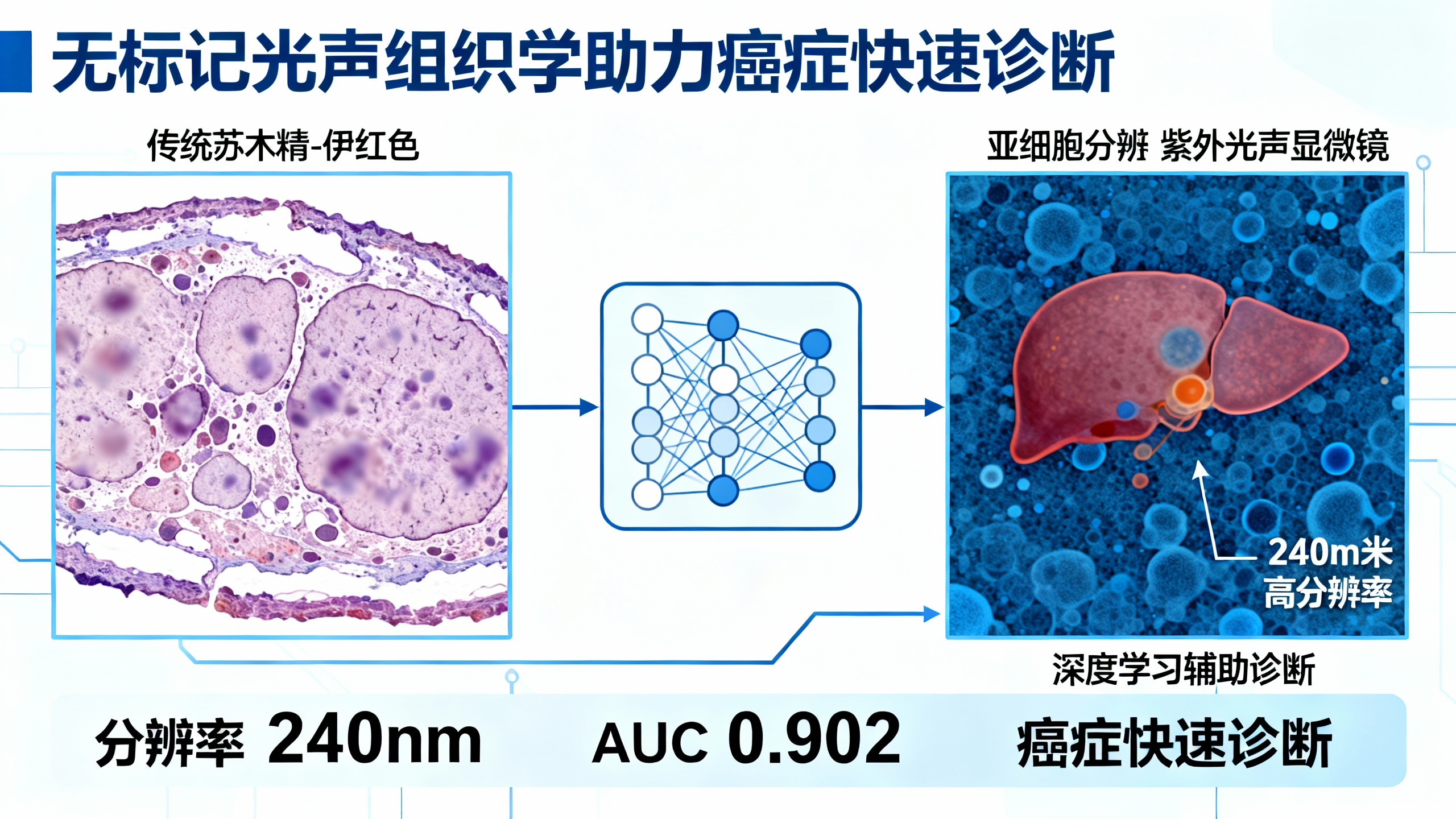 用人工智能快速无标记光声技术诊断癌症