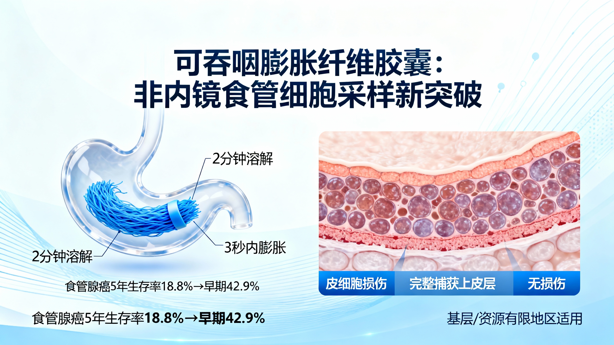 可吞咽的膨胀纤维胶囊：无需胃镜即可采集食管细胞