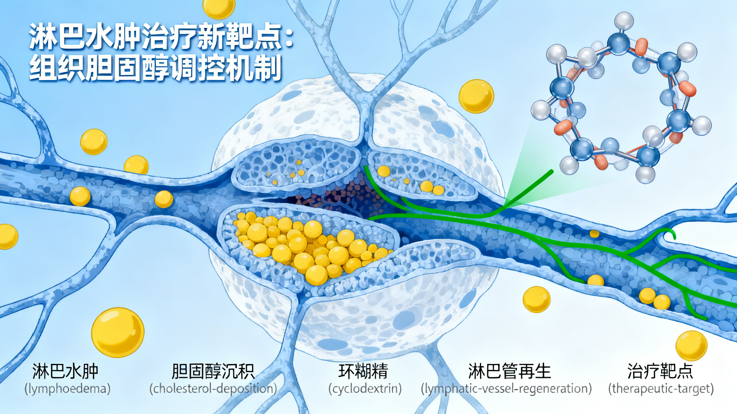 减少胆固醇过度堆积，缓解继发性淋巴水肿