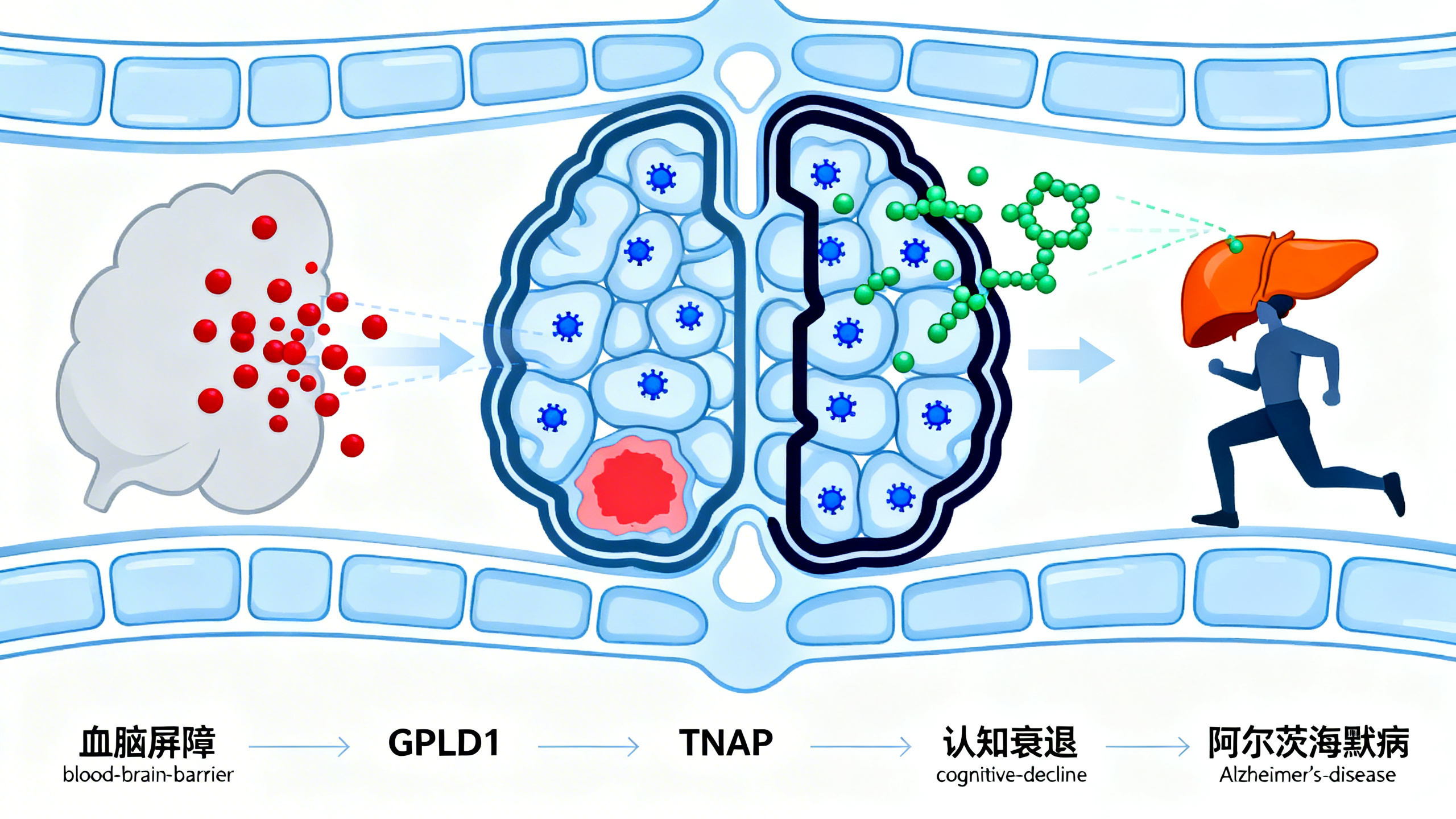 运动如何保护大脑、预防阿尔茨海默病