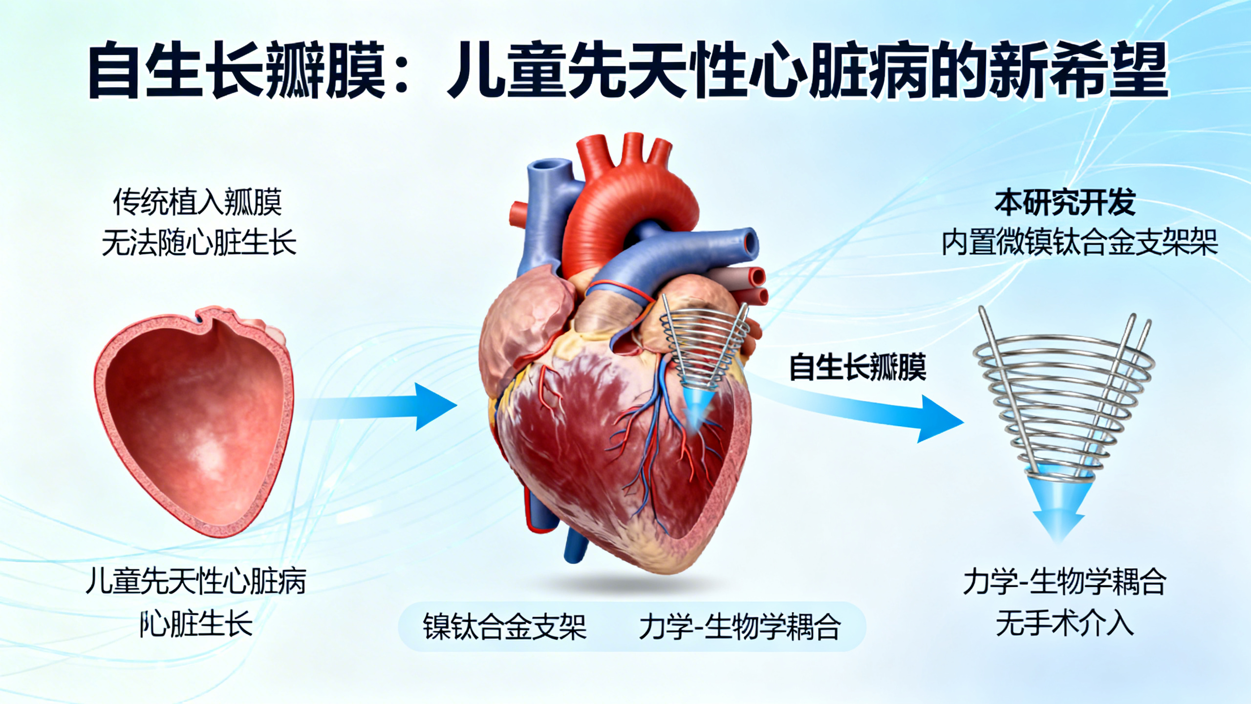 无需手术就能“长”出人工心脏瓣膜