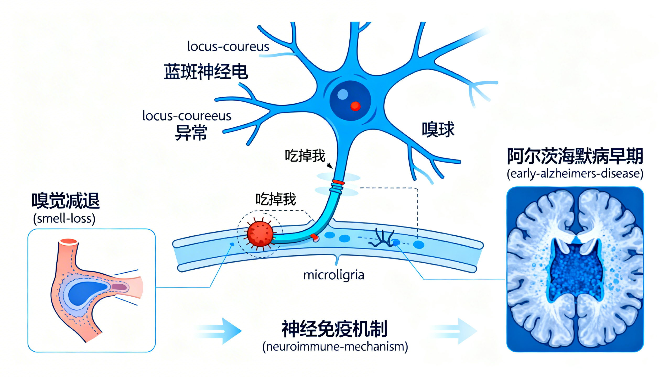 鼻子或能提前数年发现阿尔茨海默病