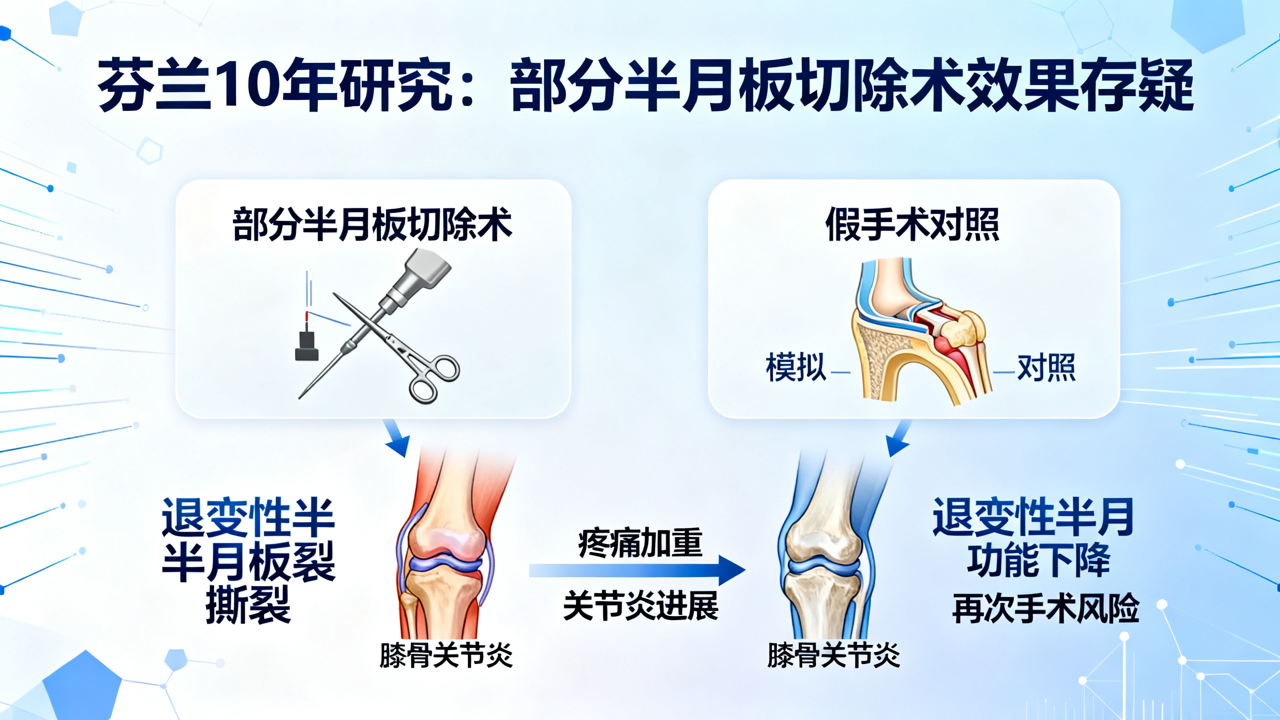常见的膝关节手术效果不佳，甚至可能加重病情
