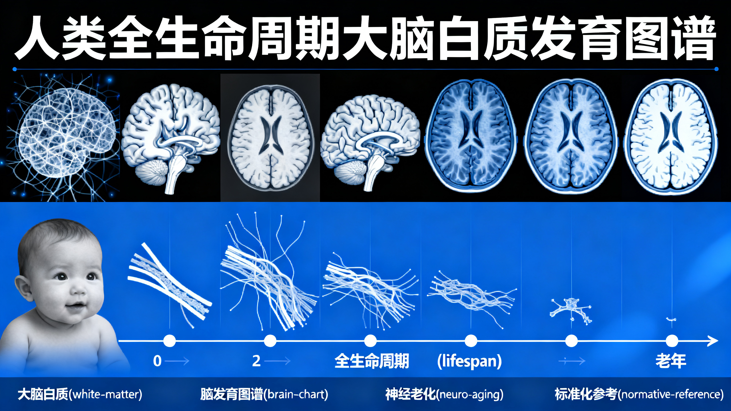大脑“信息高速公路”如何随年龄变化