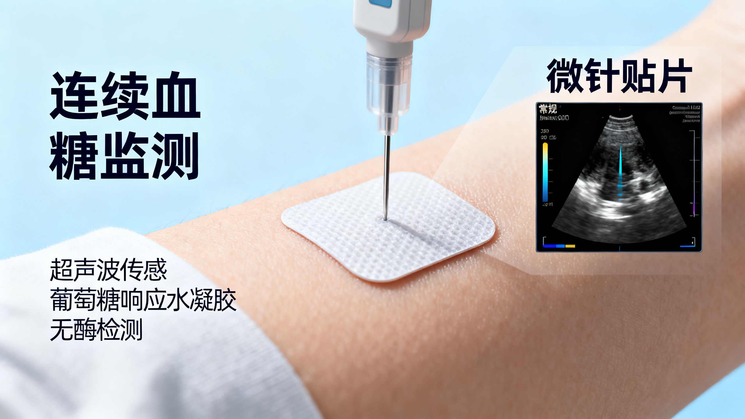 可穿戴超声贴片：无痛监测血糖新方法