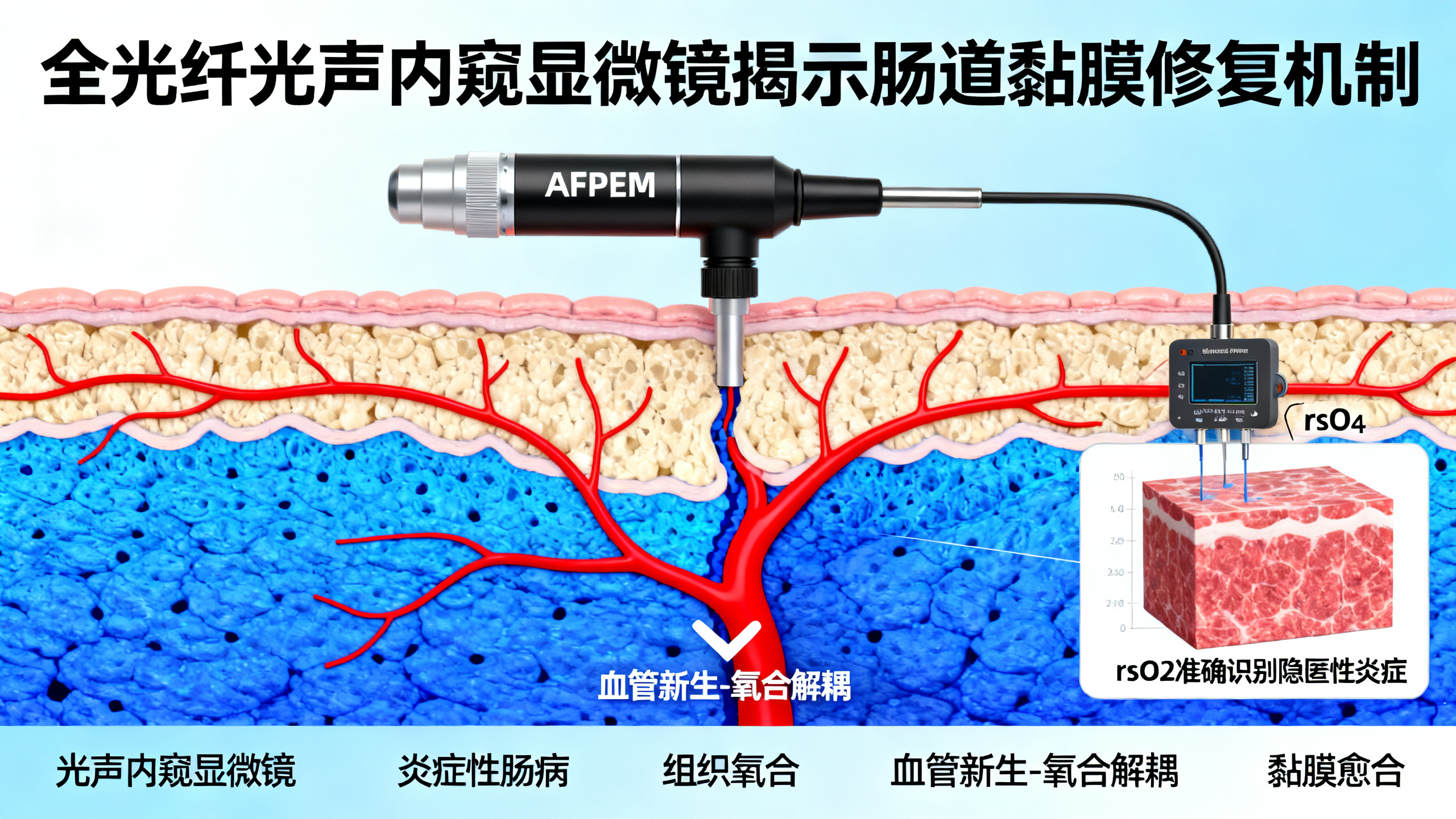 全光纤光声显微内镜发现实验性结肠炎中血管新生与供氧“脱钩”现象