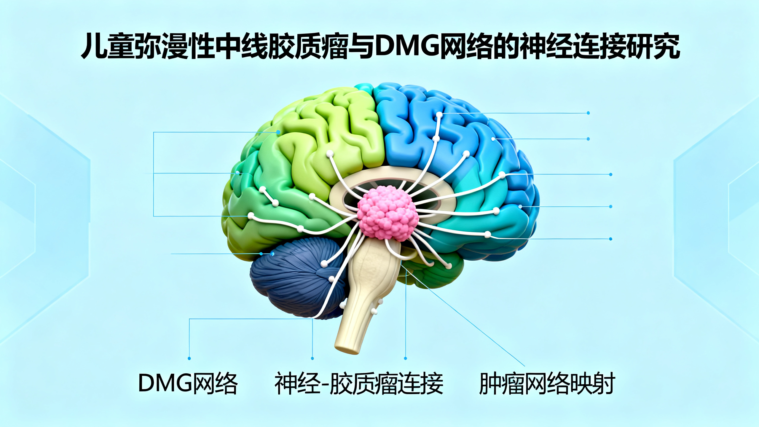 预测弥漫性中线胶质瘤病情发展的脑网络