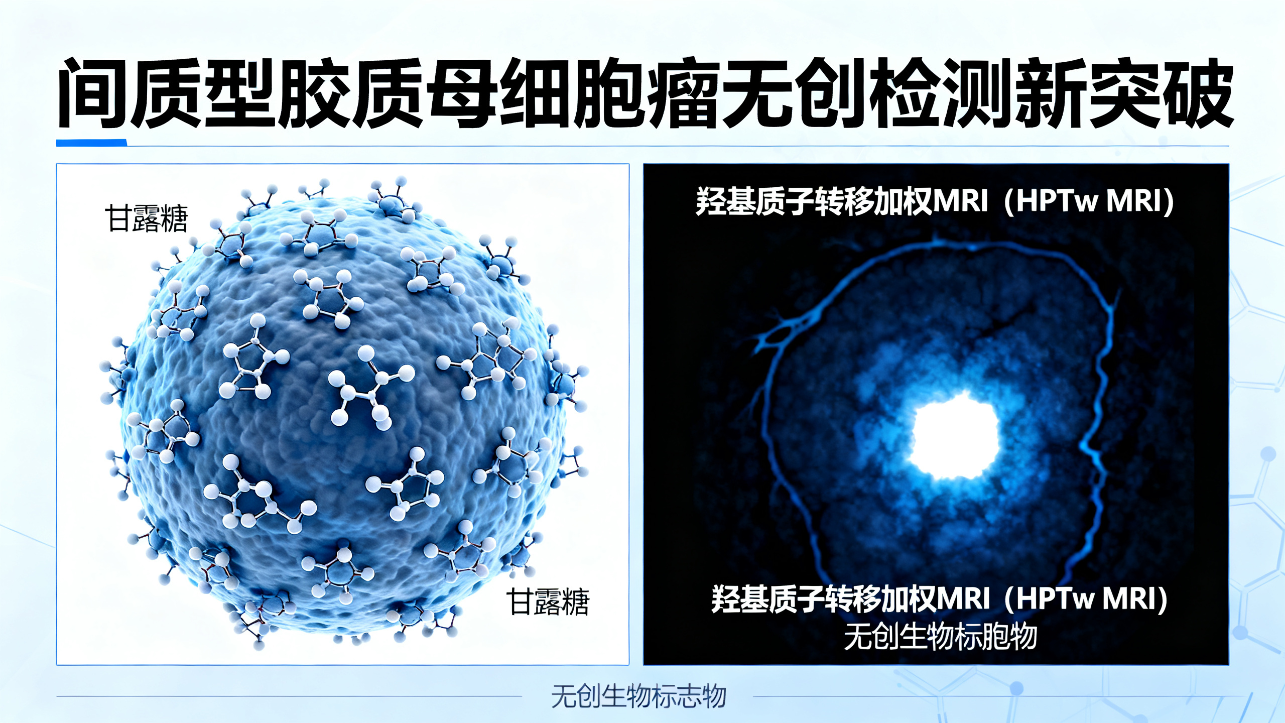 高甘露糖含量与脑胶质母细胞瘤恶性程度相关，可借助新型磁共振成像技术无创评估