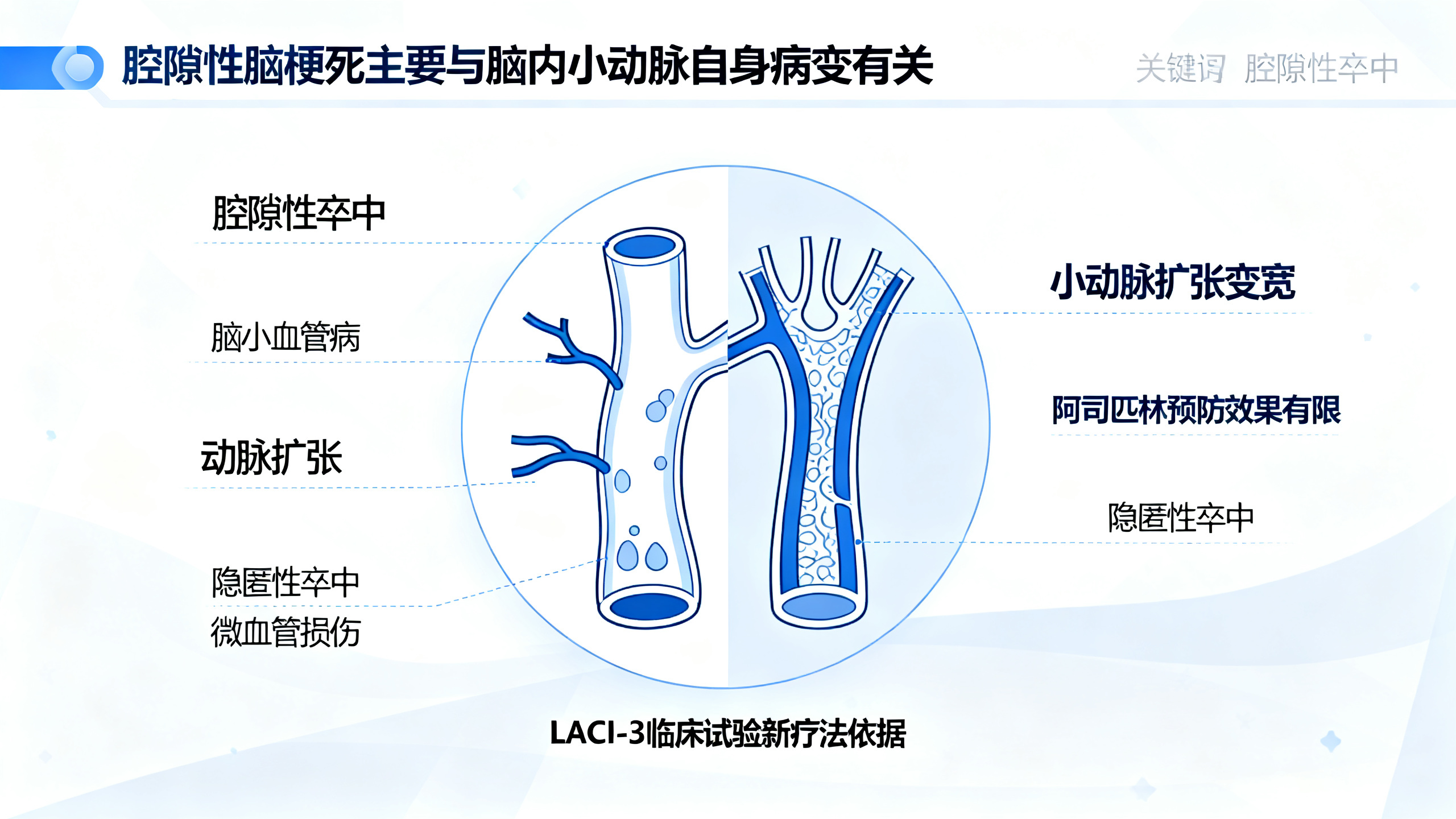 常见中风的真正原因，可能被忽视了几十年
